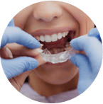 Эстетическая стоматология в SiriusDent