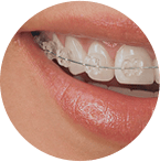 Ортодонтия в стоматологии SiriusDent