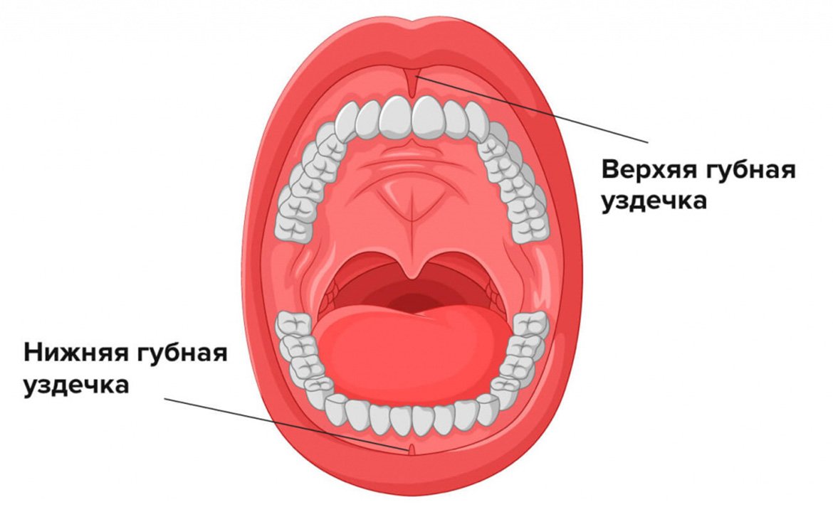 верхняя и нижняя губная уздечка