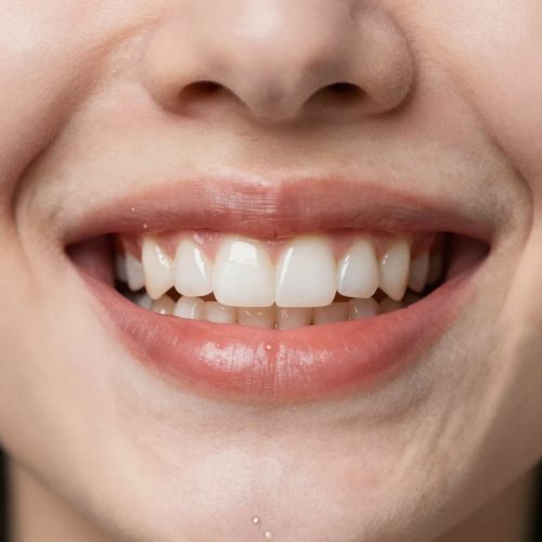 Установка имплантатов: какие ошибки чаще всего совершают пациенты