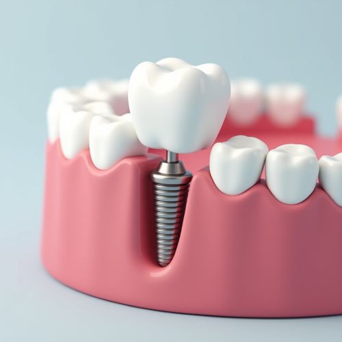 Имплантация после 50, 60 и 70 лет: есть ли возрастные ограничения