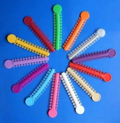 Обычные и самолигирующие брекеты - в чём разница? Обычные и самолигирующие брекеты - в чём разница?