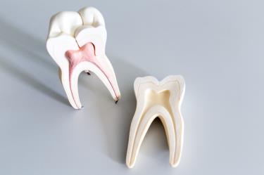 Корневые каналы зуба